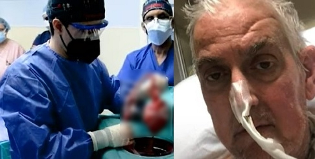 প্রথমবারের মতো মানবদেহে প্রতিস্থাপিত হলো শূকরের হৃদপিণ্ড