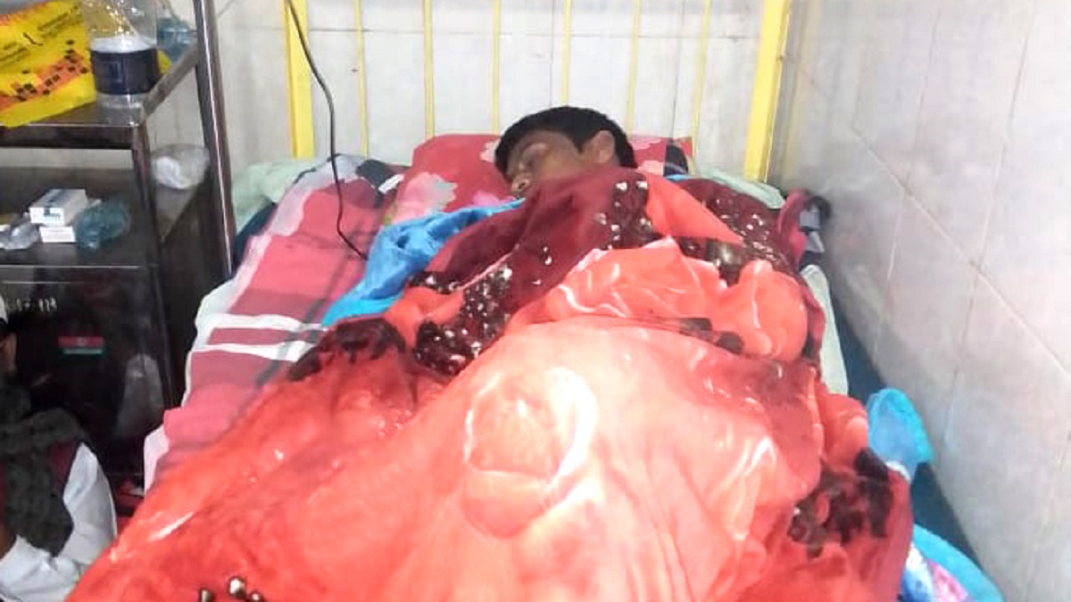 পাবনায় বাসাবাড়িতে সপ্তাহ না যেতেই ফের হামলা, যুবক ছুরিকাহত