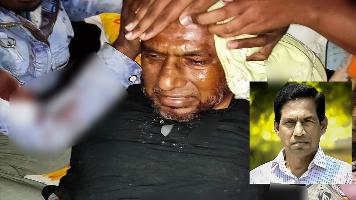 গুরুদাসপুর উপজেলা বিএনপি সভাপতির রগ কেটে দিলো প্রতিপক্ষ