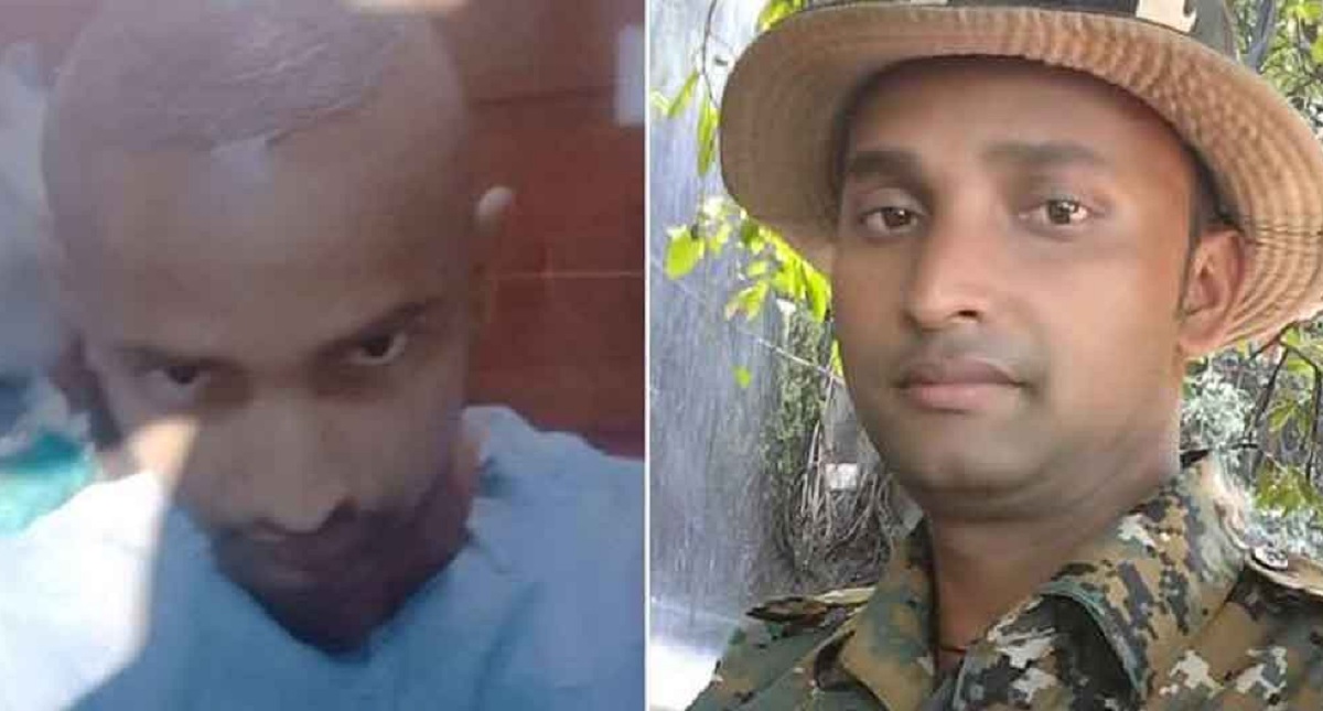 বিয়ের আগে টাক মাথায় চুল গজাতে গিয়ে যুবকের মৃত্যু!