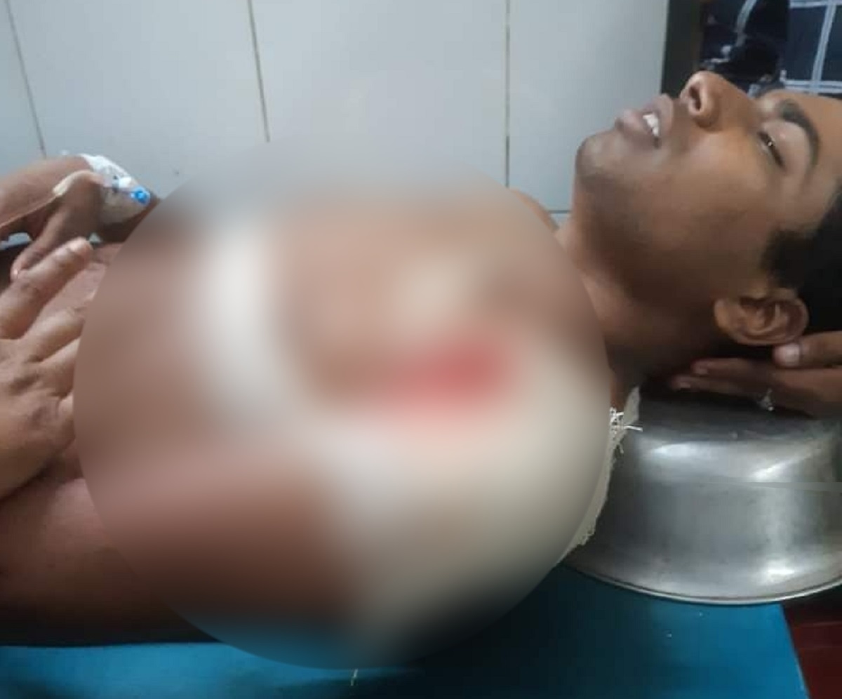 ভিড়ের মধ্যে ধাক্কাধাক্কি, স্কুলছাত্রকে কুপিয়ে জখম কিশোর গ্যাংয়ের