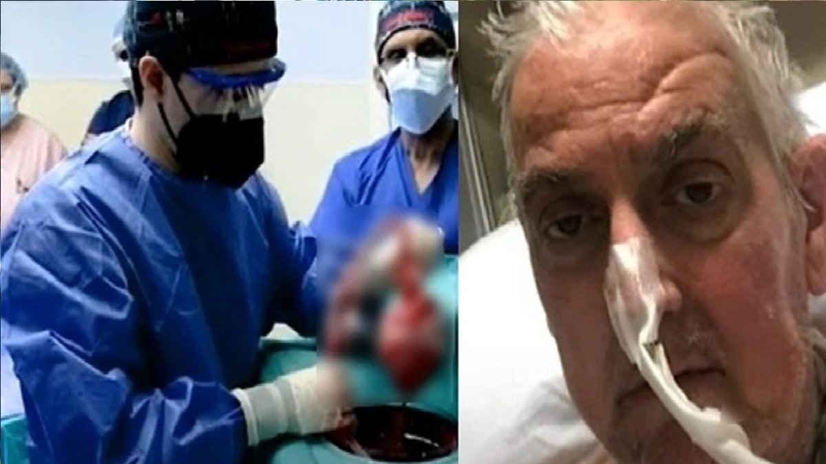 শূকরের হৃদপিণ্ড নেয়া সেই ব্যক্তি মারা গেছেন