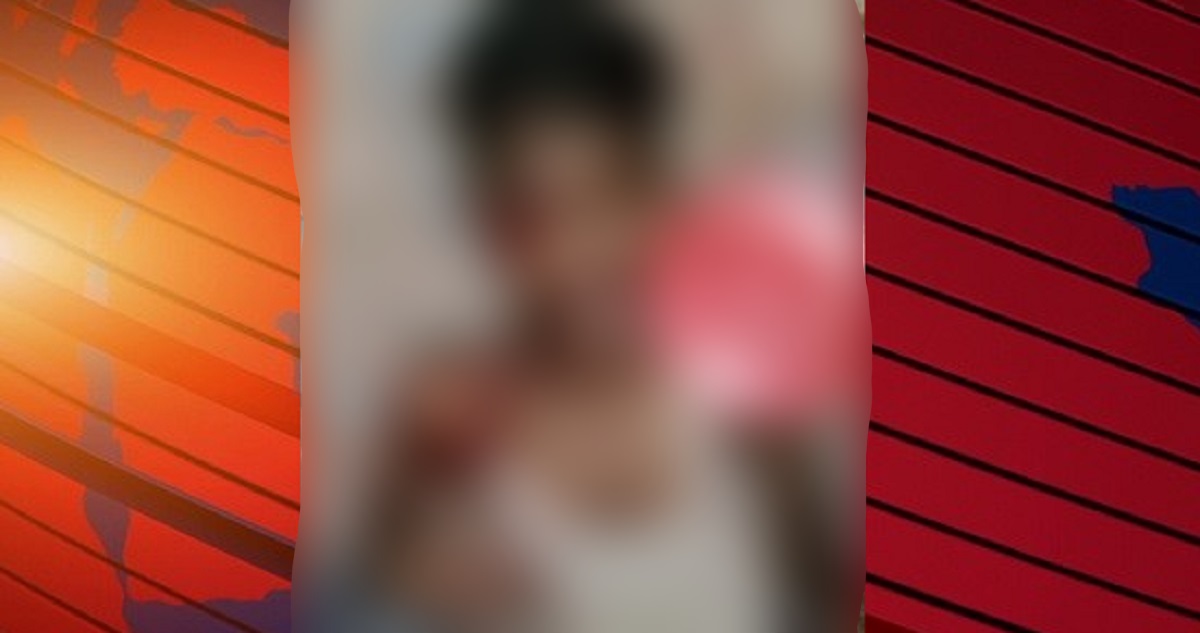 পিরোজপুরে নিজের বানানো আতশবাজিতে ঝলসে গেছে যুবকের হাত, চোখ