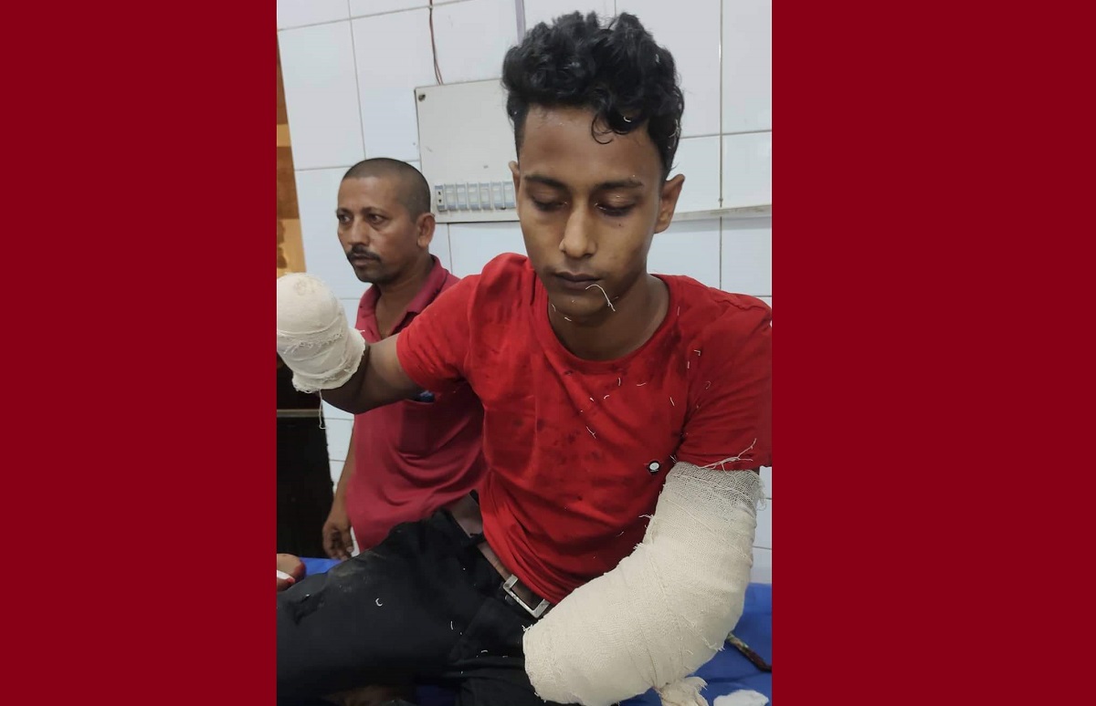 চাচির সাথে পরকীয়া, যুবকের দুই হাতের কব্জি কেটে নিলো ফুফা