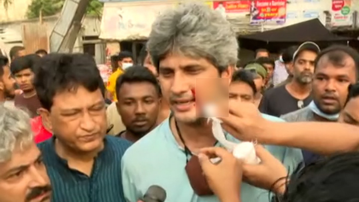 চট্টগ্রামে হামলার শিকার জোনায়েদ সাকি