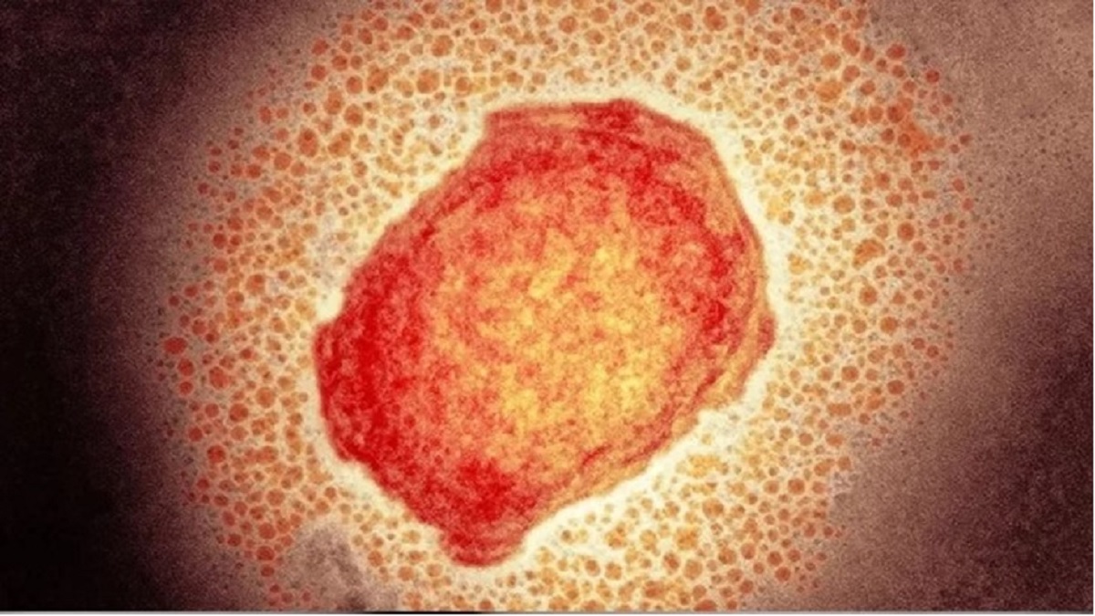 মাঙ্কিপক্সে আফ্রিকার পর প্রথম মৃত্যু দেখলো ব্রাজিল