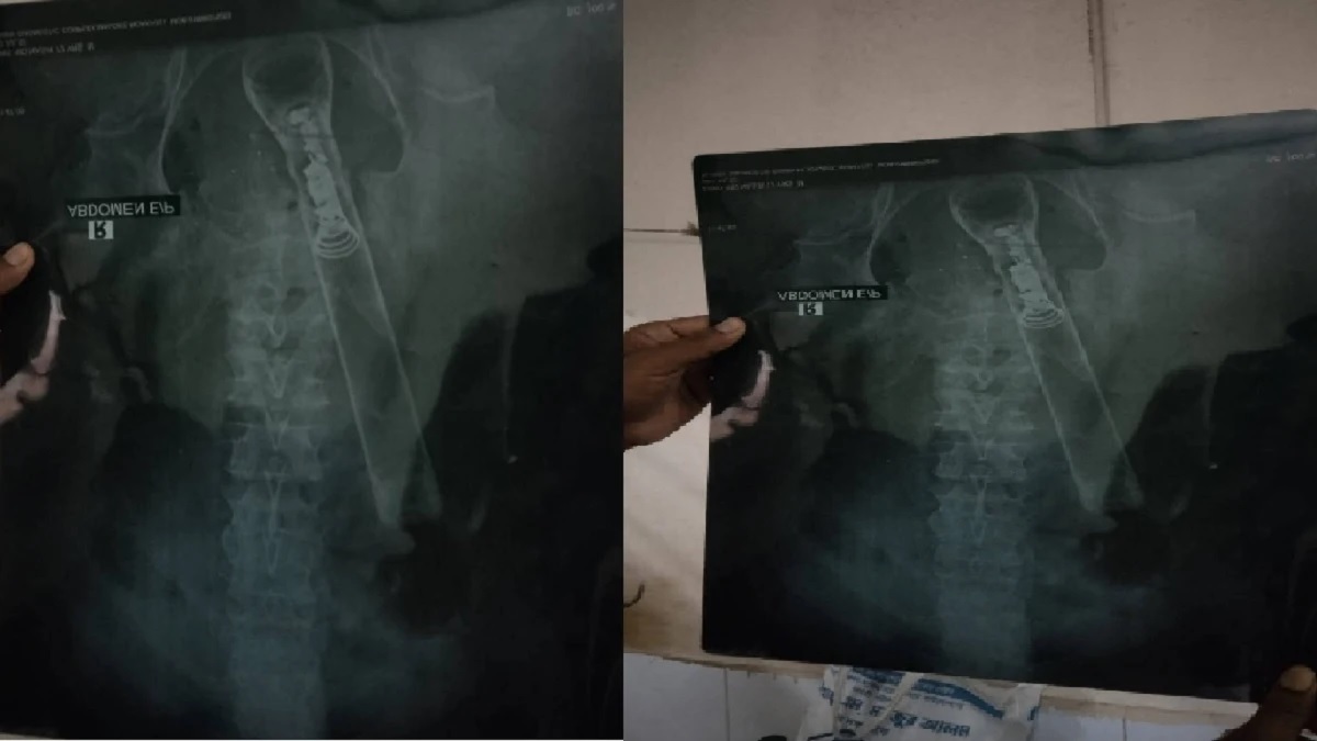 বৃদ্ধের পায়ুপথে টর্চলাইট ঢুকিয়ে নির্যাতন: ওয়ার্ড যুবলীগ সভাপতি সানাজ গ্রেফতার