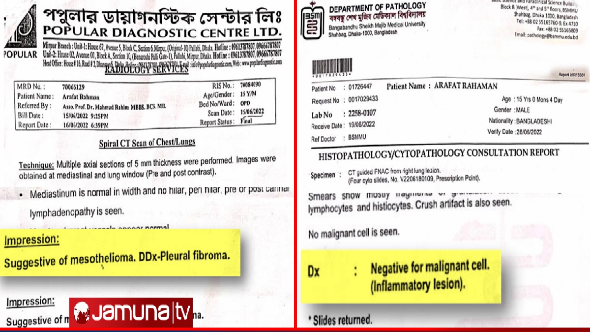 দুই ডায়াগনস্টিক সেন্টার জানালো ‘ক্যানসার’; দেশবিদেশ ঘুরে মিললো ভিন্ন রিপোর্ট
