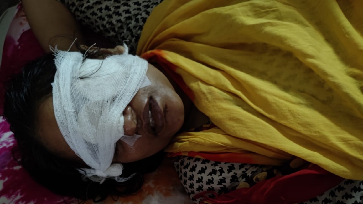 ক্লাস চলাকালীন হঠাৎ বাঁশে বাঁধা ফ্যান খুলে পড়ে চোখ হারালেন শিক্ষক