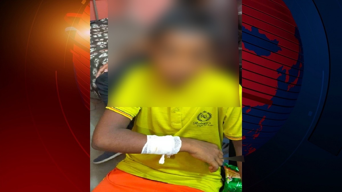 নাটোরে শিশুকে সিগারেটের ছেঁকা ও মারপিটের অভিযোগ, এক হাজার টাকায় রফা