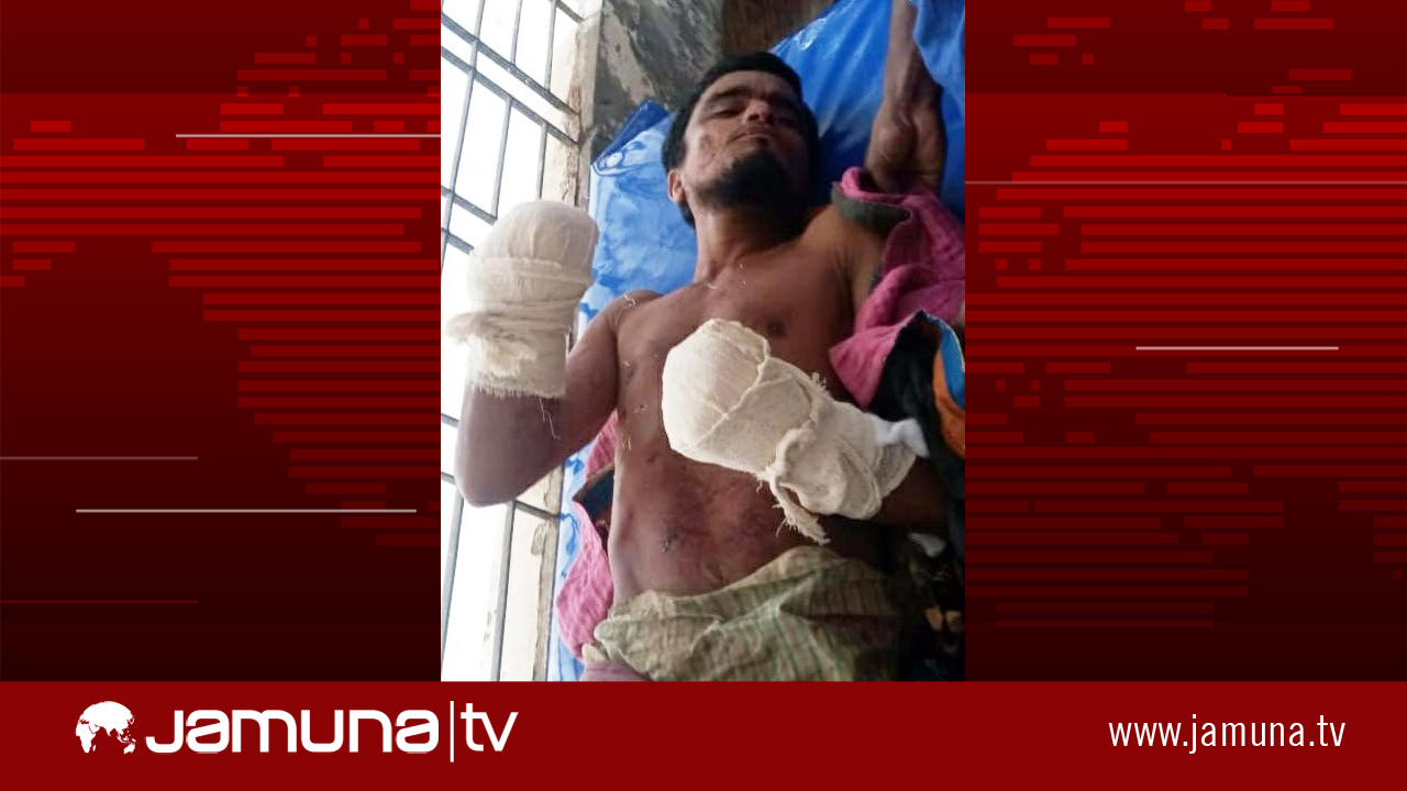 পিরোজপুরে স্বামীর দুই হাতের কব্জি বিচ্ছিন্ন করলো স্ত্রী