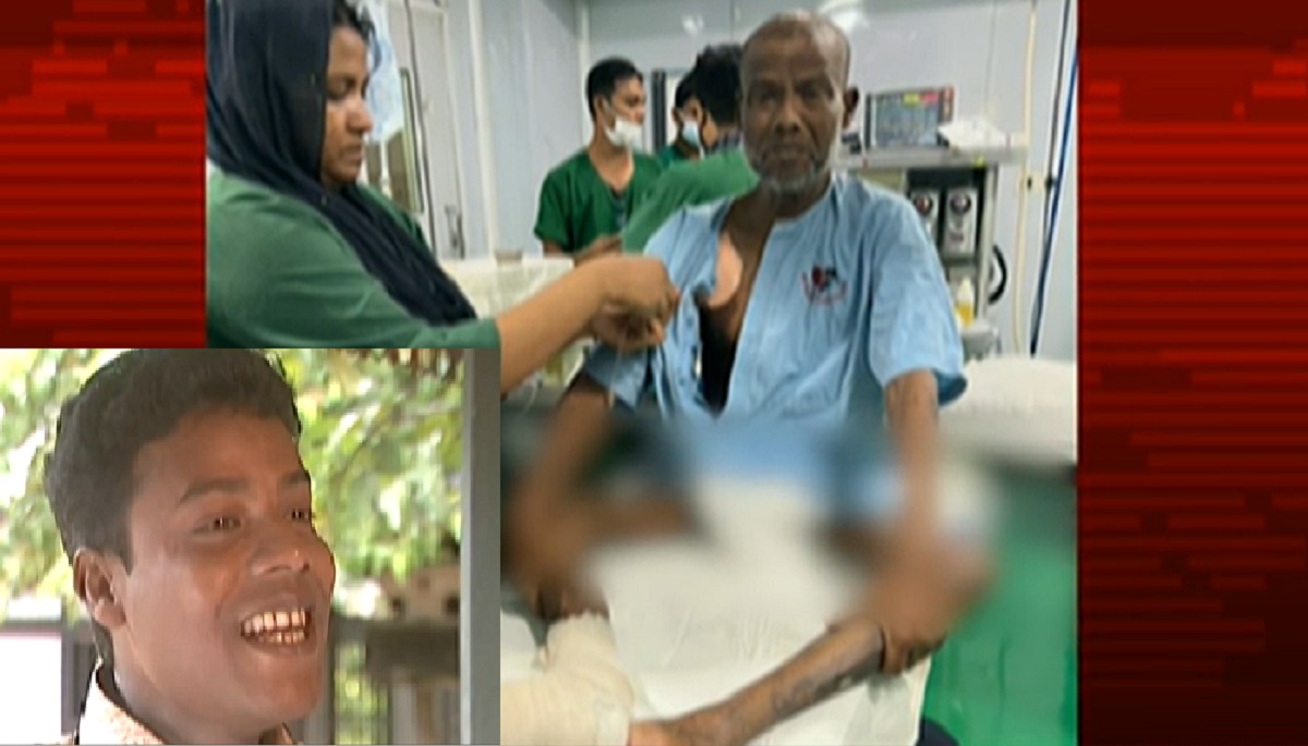 কাটতেই হলো কণ্ঠশিল্পী আকবরের পা