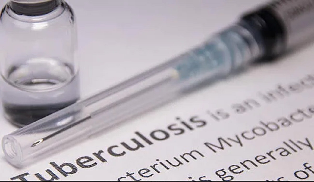 মাথাচাড়া দিয়েছে যক্ষ্মা, দুই বছরে মৃত্যু বেড়েছে ১৪ শতাংশ: ডব্লিউএইচও