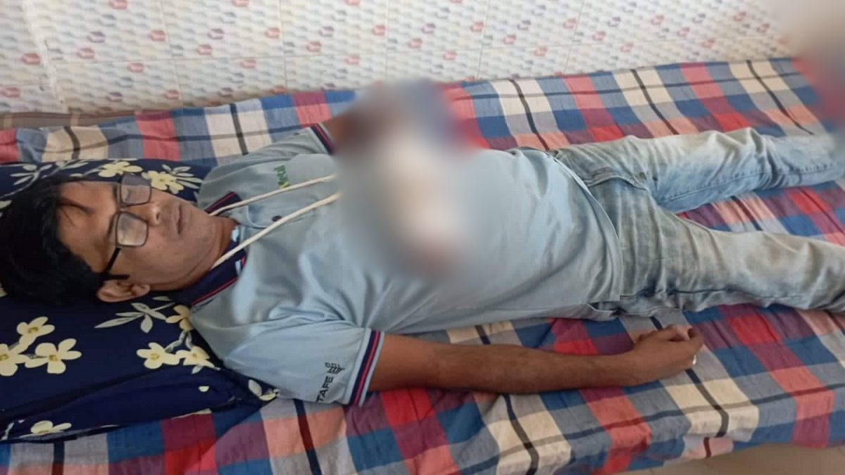 পাংশায় পিটিয়ে দলিল লেখকের হাত ভেঙে দেয়ার অভিযোগ