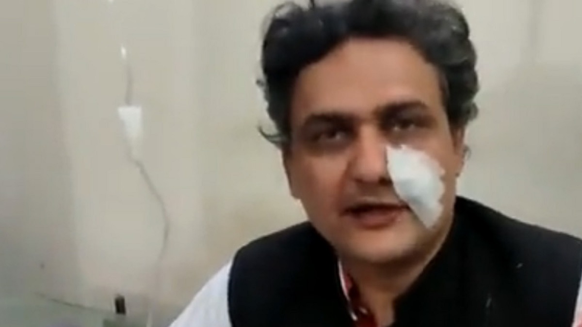 গুলিবিদ্ধ হয়ে হাসপাতালে ইমরান খান, দোয়া চাইলেন পিটিআই নেতা