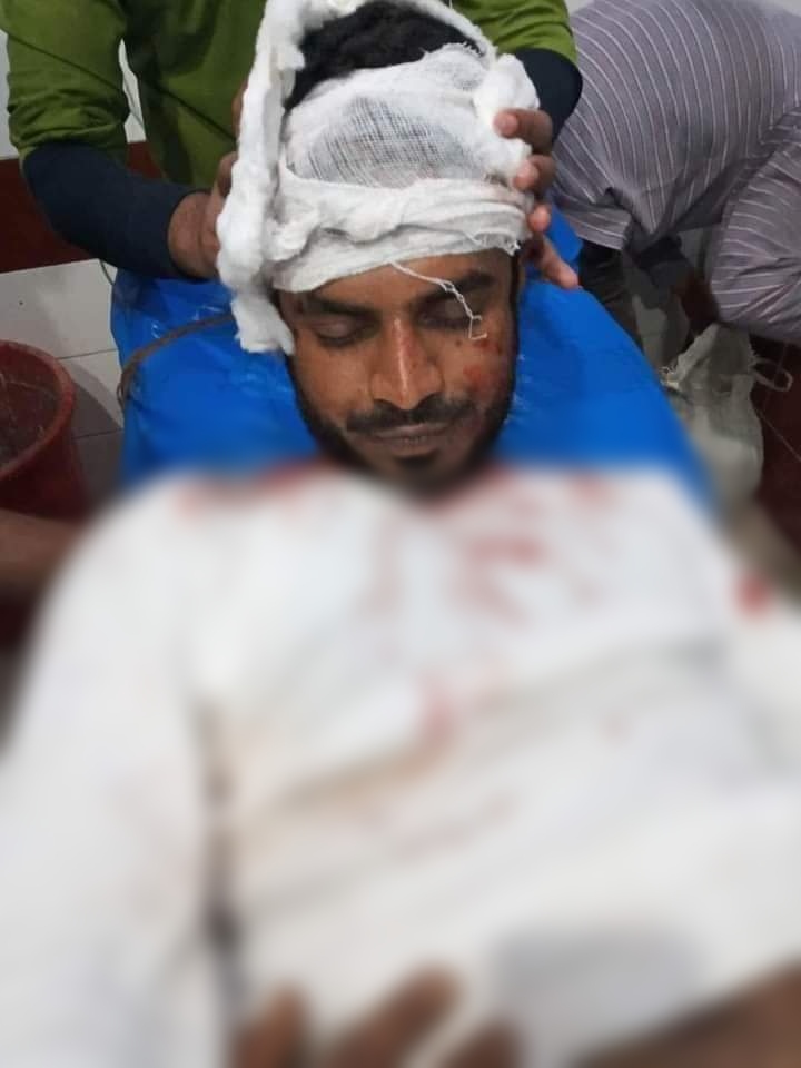 ব্রাহ্মণবাড়িয়ায় ইভটিজিংয়ের প্রতিবাদ করায় যুবককে কুপিয়ে জখম