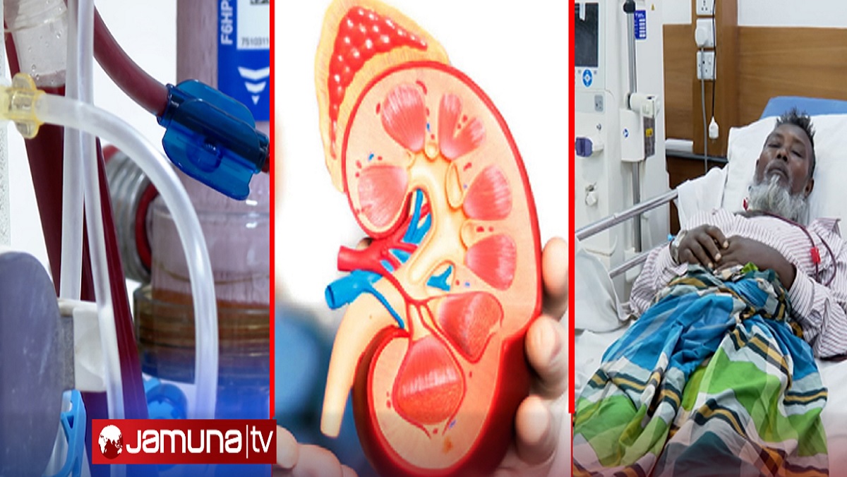 কিডনির চিকিৎসায় নিঃস্ব রোগী, শনাক্ত ও মৃতের সংখ্যা দ্বিগুণ!