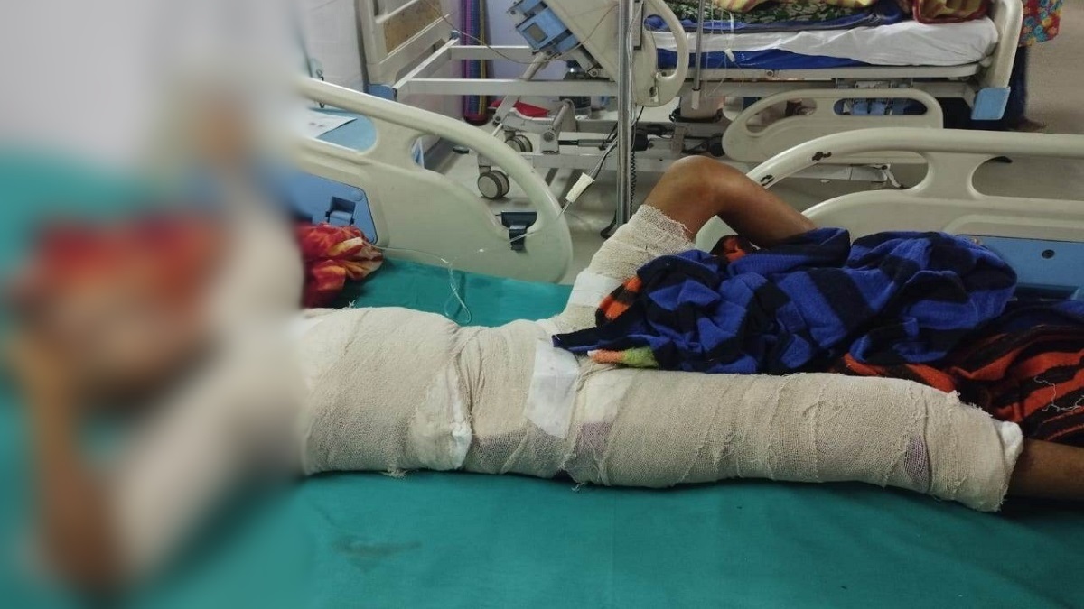 দগ্ধ মরিয়মকে বাঁচাতে মায়ের আকুতি