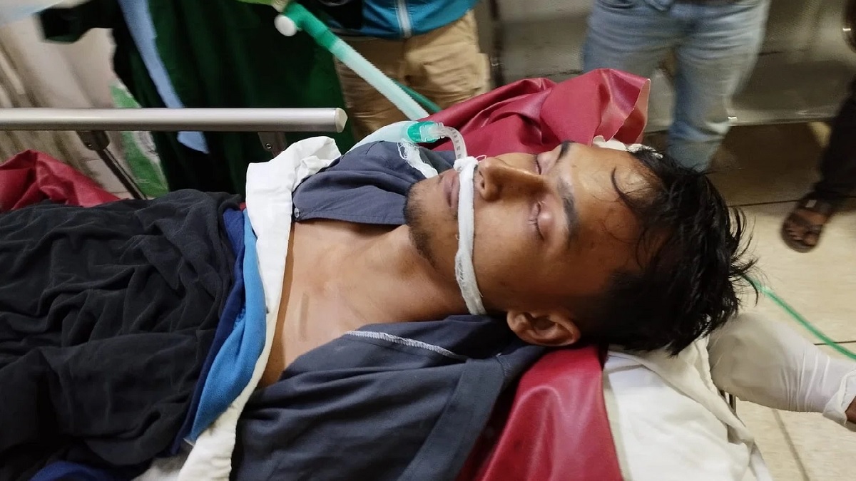 সড়ক দুর্ঘটনায় আহত জাবি শিক্ষার্থীর অবস্থার উন্নতি