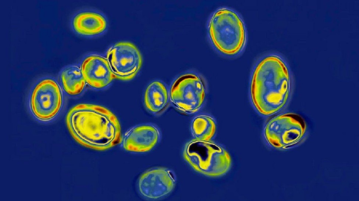 যুক্তরাষ্ট্রে ছড়িয়ে পড়ছে ক্যান্ডিডা অরিস নামের ফাঙ্গাল ইনফেকশনের সংক্রমণ