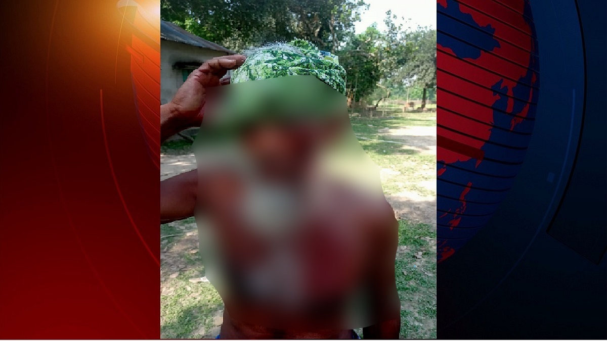 গাজীপুরে জমি সংক্রান্ত বিরোধ: প্রতিপক্ষের হামলায় চাচা-ভাতিজাসহ আহত ৩