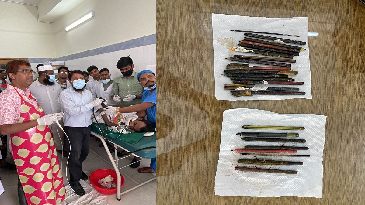 সেই মোতালেবের পেট থেকে বের করা হলো আরও ৮টি কলম