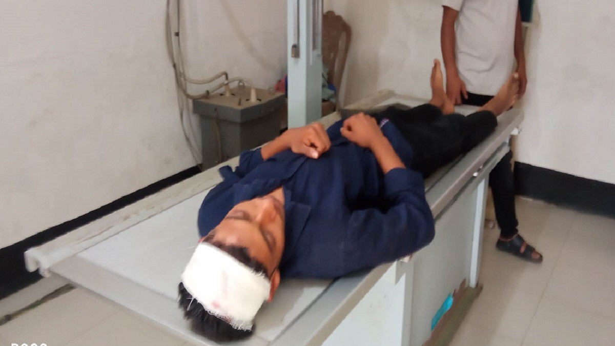 বোয়ালমারীতে স্কুলে যাওয়ার পথে ৯ম শ্রেণির শিক্ষার্থীকে কুপিয়ে জখম
