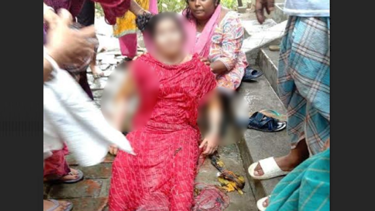 পটুয়াখালীতে দুর্বৃত্তের দেয়া আগুনে দগ্ধ গৃহবধূর মৃত্যু, শাশুড়ি গ্রেফতার