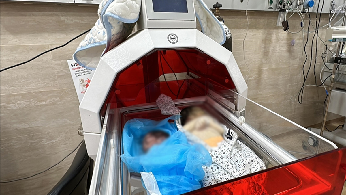 অপুষ্টি ও পানিশূন্যতায় গাজায় মৃত্যু হলো দুই শিশুর