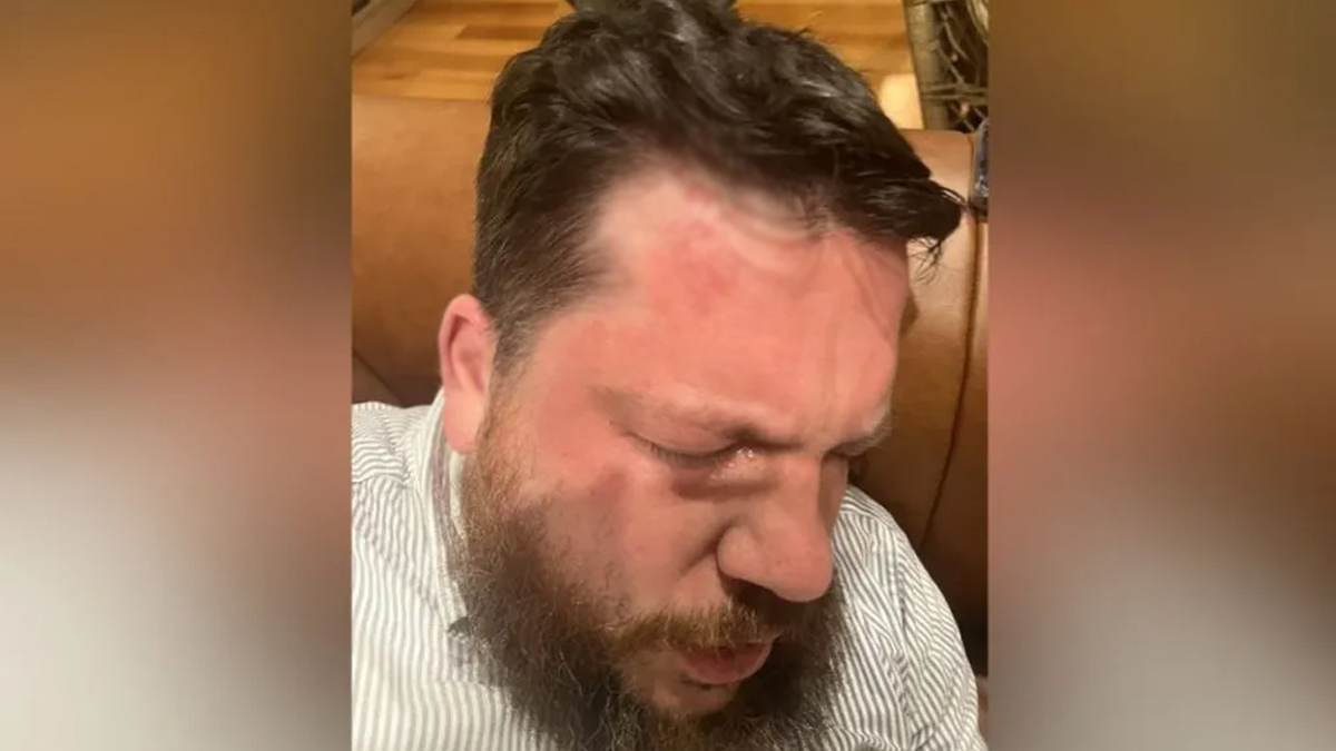 লিথুয়ানিয়ায় হামলার শিকার নাভালনির সহযোগী