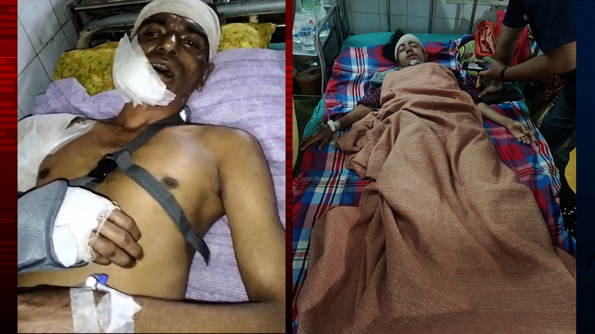 ঘুমন্ত দম্পতির ওপর হামলা, গুরুতর জখম স্বামী-স্ত্রী