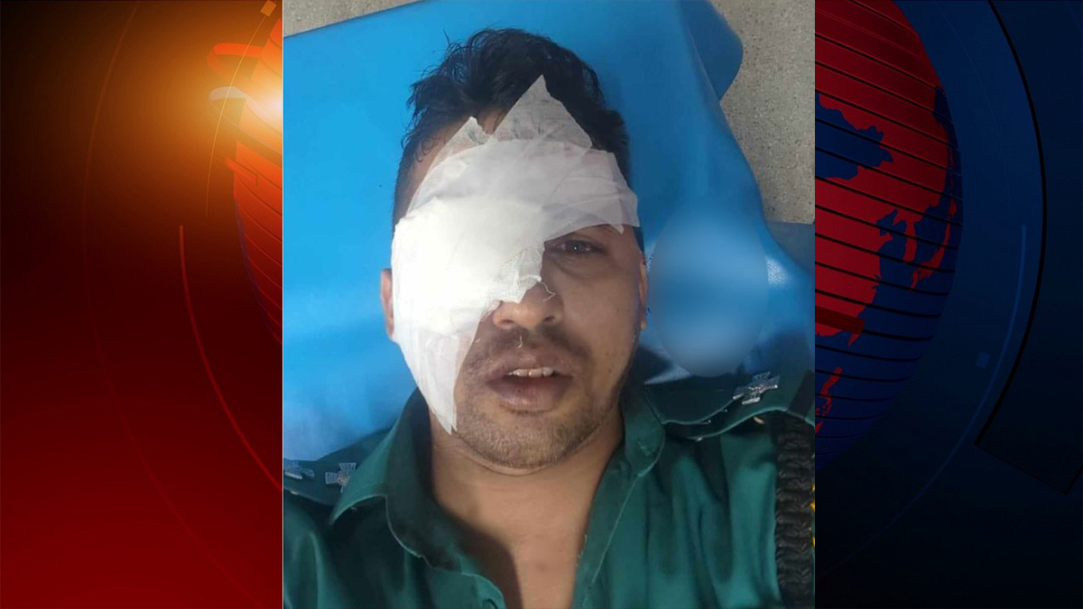 হিজড়াদের হামলায় চোখ হারালেন পুলিশের এসআই