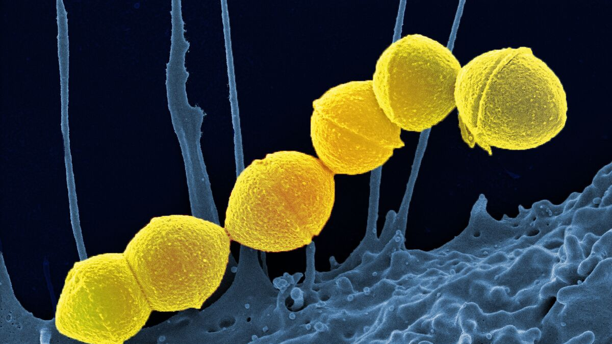 মারাত্মক ‘মাংস খাওয়া’ ব্যাকটেরিয়া ছড়িয়ে পড়ছে জাপানে