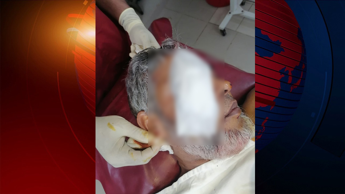 কোটা আন্দোলন: পুলিশের গুলিতে গুলিবিদ্ধ জাবি শিক্ষক