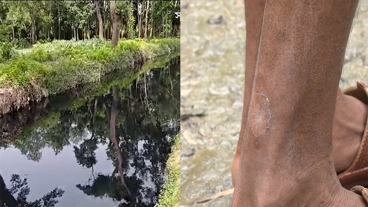 ভারত থেকে ভেসে আসা বর্জ্যে ব্রাহ্মণবাড়িয়ায় বাড়ছে পানিবাহিত রোগ