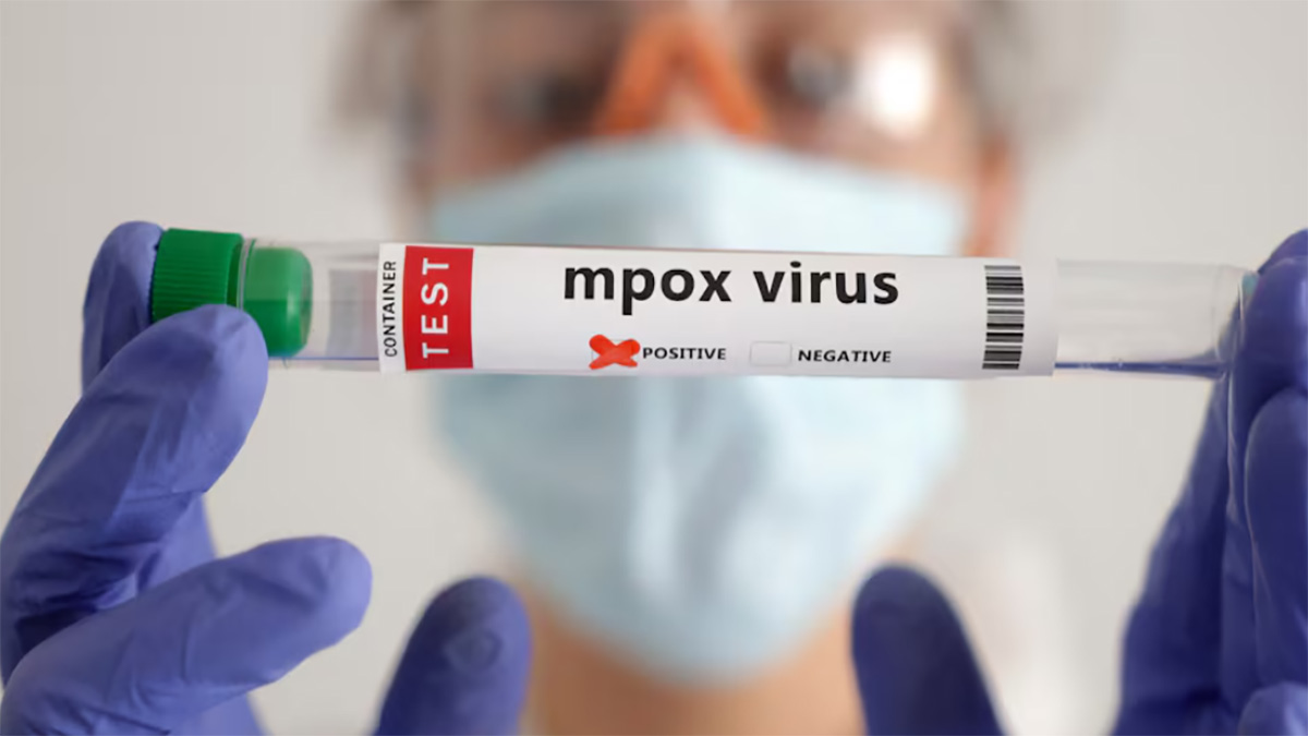 এমপক্সের টিকার প্রথম চালান পেলো কঙ্গো