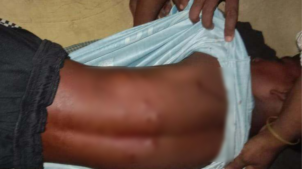 রোহিঙ্গা ক্যাম্পে দুই সশস্ত্র বাহিনীর গোলাগুলিতে নিহত ১