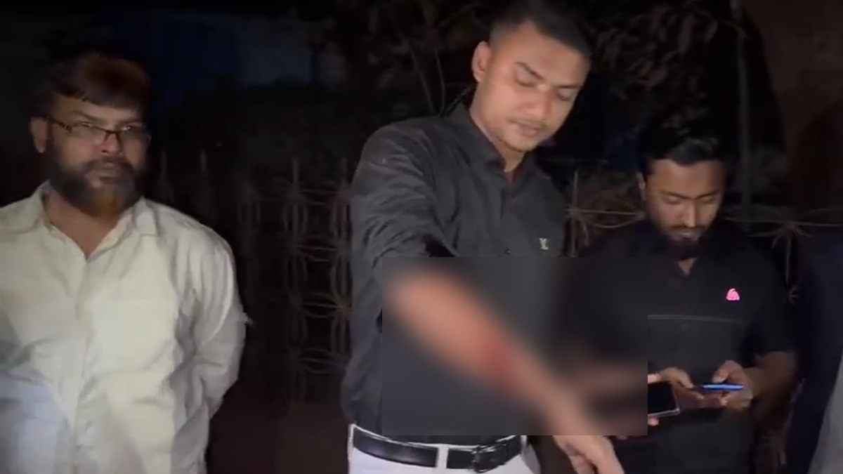 গাজীপুরে ডিসি অফিসের সামনে বৈষম্যবিরোধী ছাত্র আন্দোলনের কর্মীকে গুলি