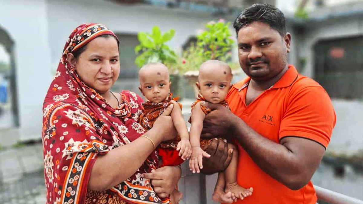 ঢামেকে চার ঘণ্টার অস্ত্রোপচারে আলাদা হলো জমজ শিশু জুহি-রুহি, আজ ফিরছে বাড়িতে